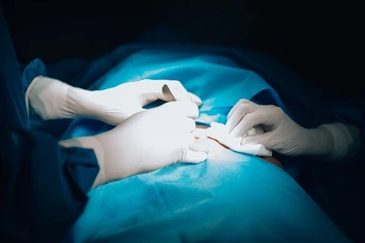 O papel central das microagulhas na prevenção e tratamento de cicatrizes cirú...
